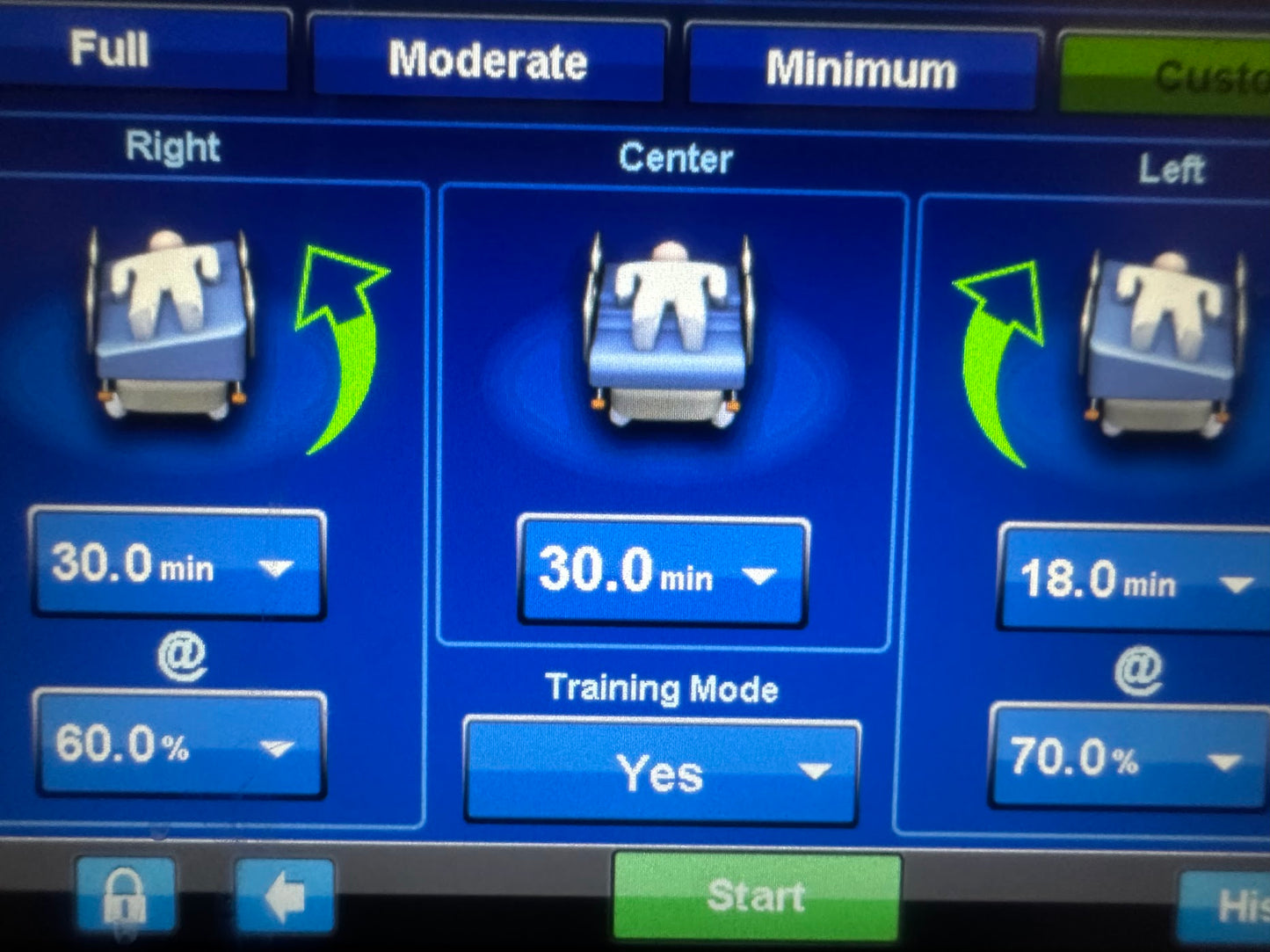 Hill Rom P7500 Progressa Bed with Patient Turning